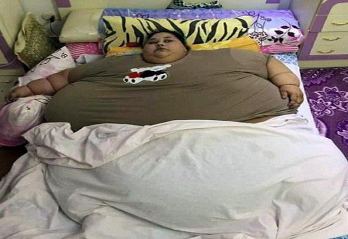 Tergemuk Sedunia, 25 Tahun Tak Bisa Bergerak